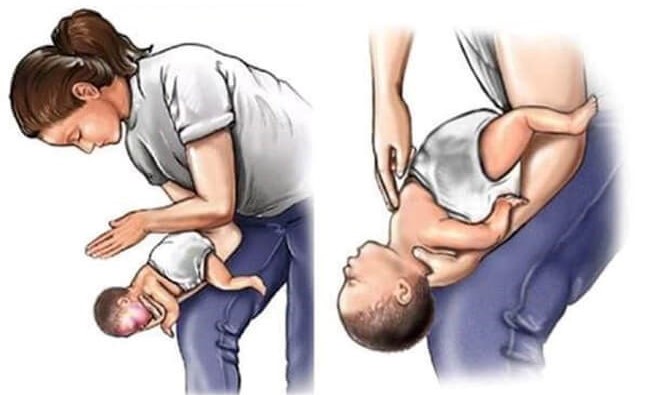 Cảnh báo nguy cơ hóc dị vật đường thở ở trẻ nhỏ